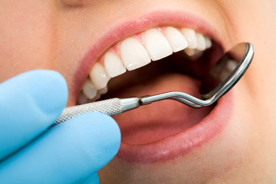 Closeup of a woman getting her teeth examined at the dentist during the COVID-19 pandemic