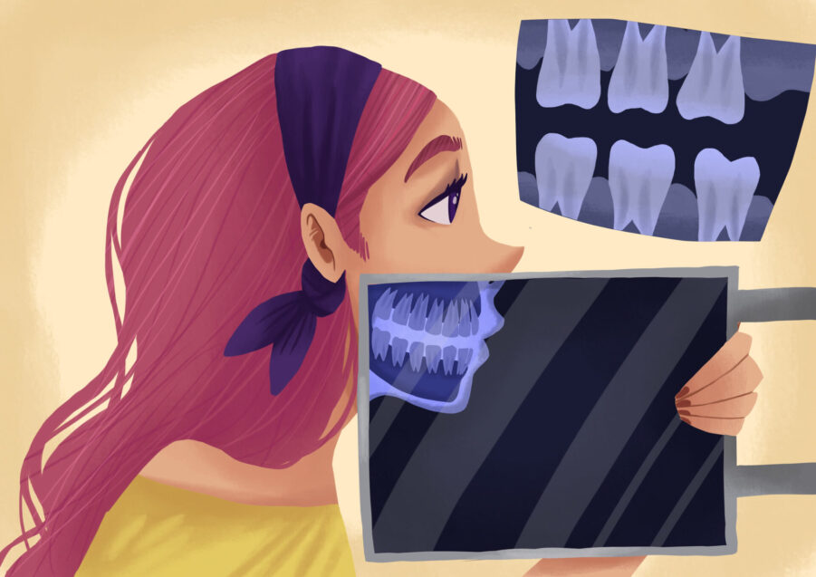 image of dental x-ray of a woman wondering are dental x-rays safe?